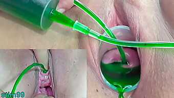 Japanese Lesbian Couple Explores Gynecological Pleasure With Vaginal And Urethral Injections